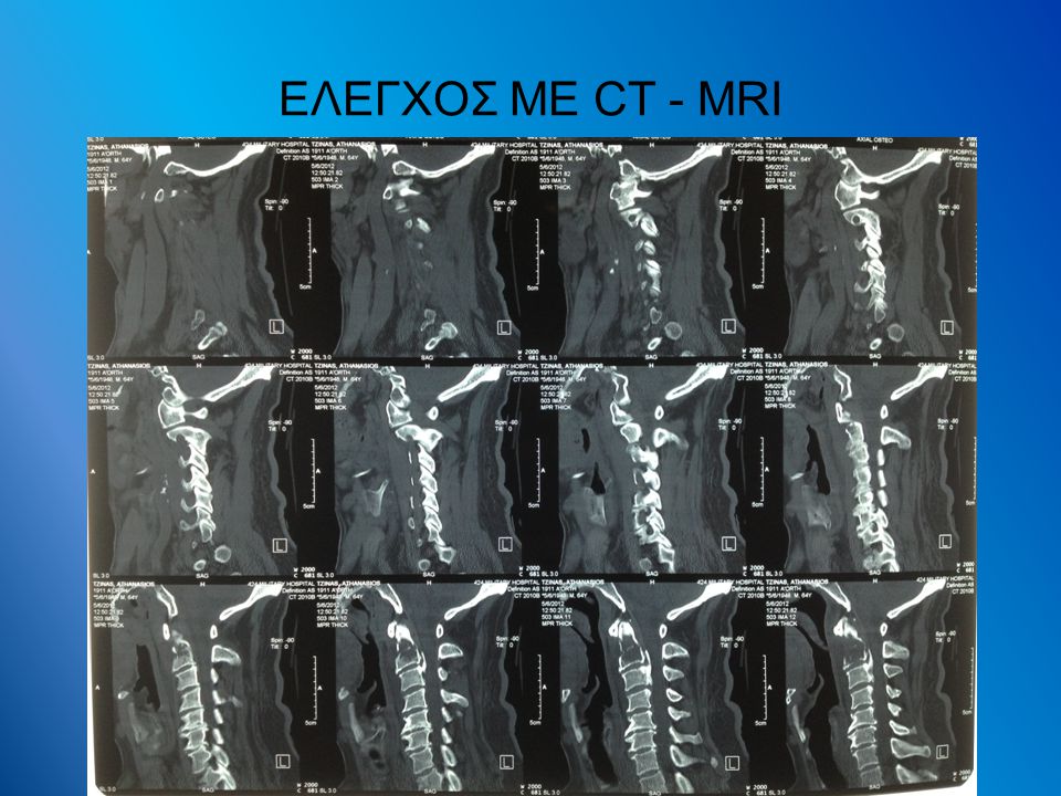 ΕΛΕΓΧΟΣ ΜΕ CT - MRI