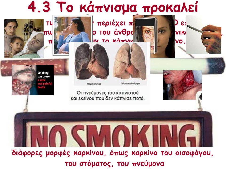 4.3 Κάπνισμα 4.3 Το κάπνισμα προκαλεί