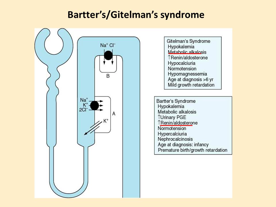 Bartter’s/Gitelman’s syndrome