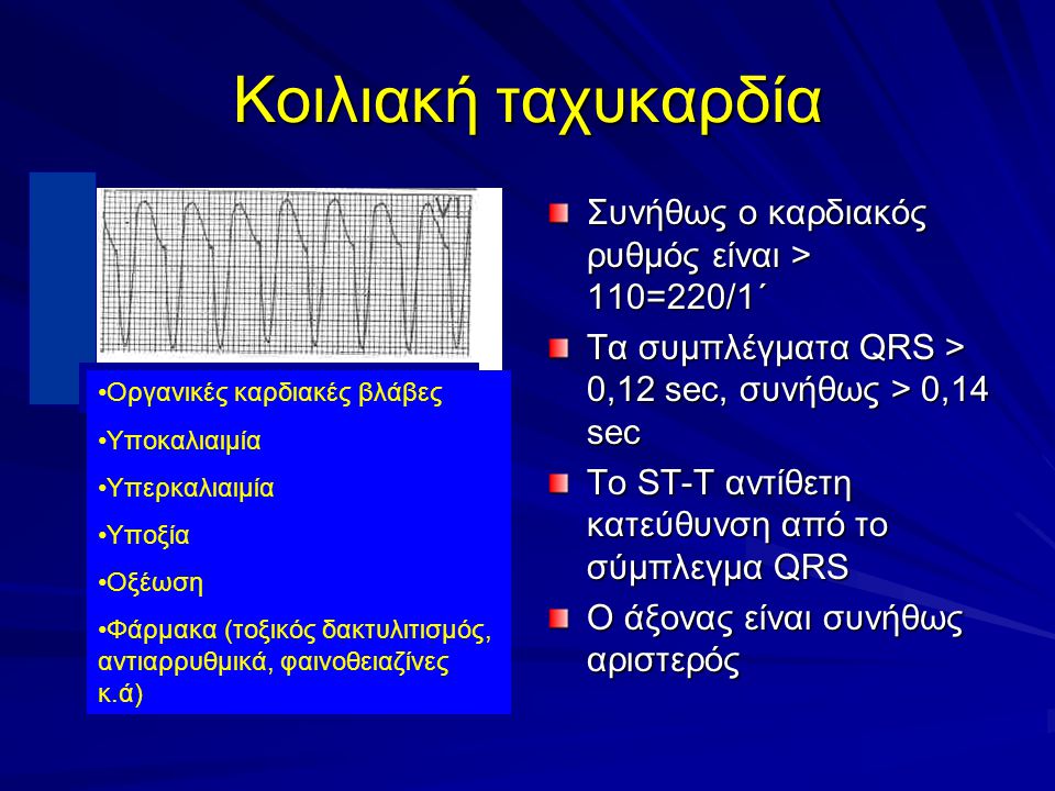 Κοιλιακή ταχυκαρδία Συνήθως ο καρδιακός ρυθμός είναι > 110=220/1΄