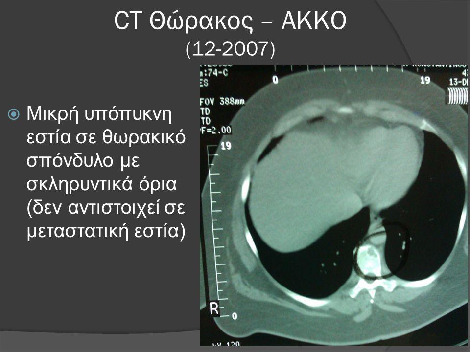 CT Θώρακος – ΑΚΚΟ ( ) Μικρή υπόπυκνη εστία σε θωρακικό σπόνδυλο με σκληρυντικά όρια (δεν αντιστοιχεί σε μεταστατική εστία)