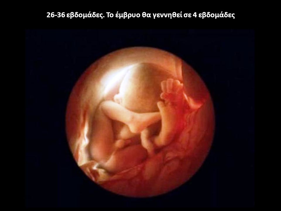 26-36 εβδομάδες. Το έμβρυο θα γεννηθεί σε 4 εβδομάδες