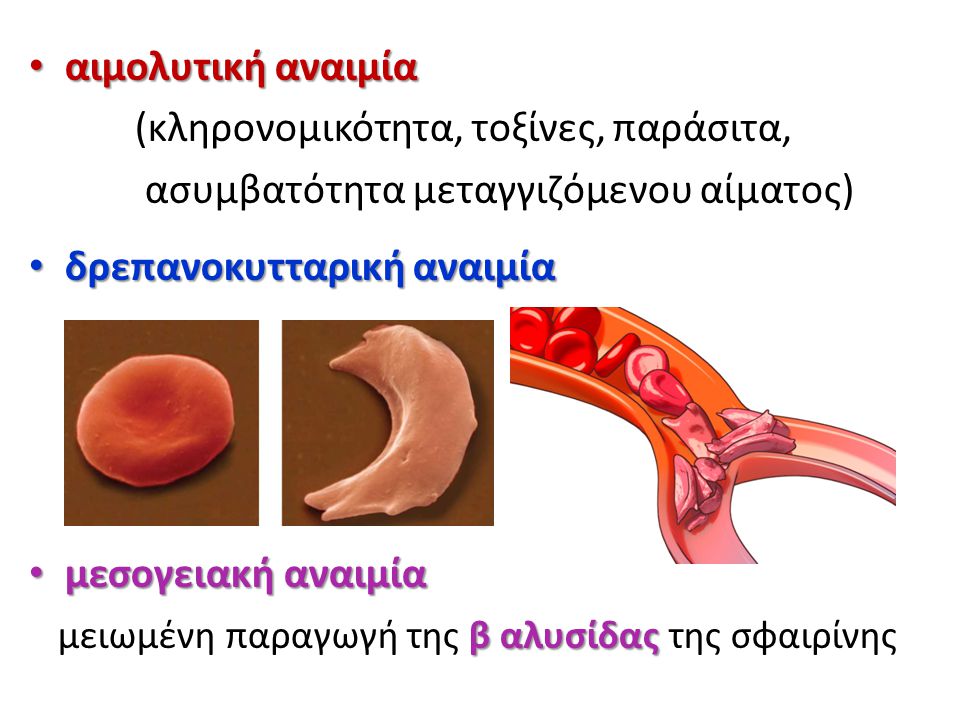 αιμολυτική αναιμία (κληρονομικότητα, τοξίνες, παράσιτα, ασυμβατότητα μεταγγιζόμενου αίματος) δρεπανοκυτταρική αναιμία.