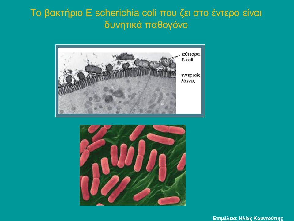 Το βακτήριο Ε scherichia coli που ζει στο έντερο είναι δυνητικά παθογόνο