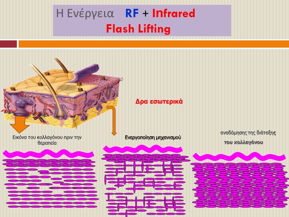 Η Ενέργεια RF + Infrared Flash Lifting