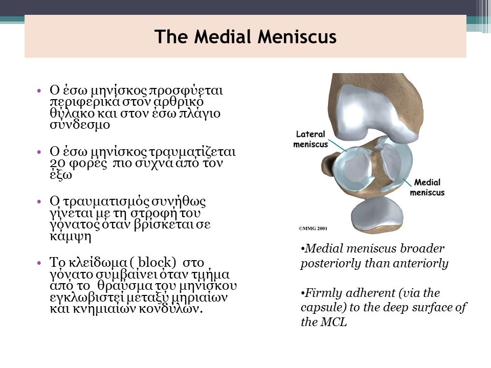 The Medial Meniscus Ο έσω μηνίσκος προσφύεται περιφερικά στον αρθρικό θύλακο και στον έσω πλάγιο σύνδεσμο.