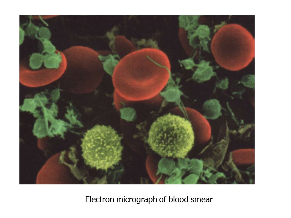 Electron micrograph of blood smear