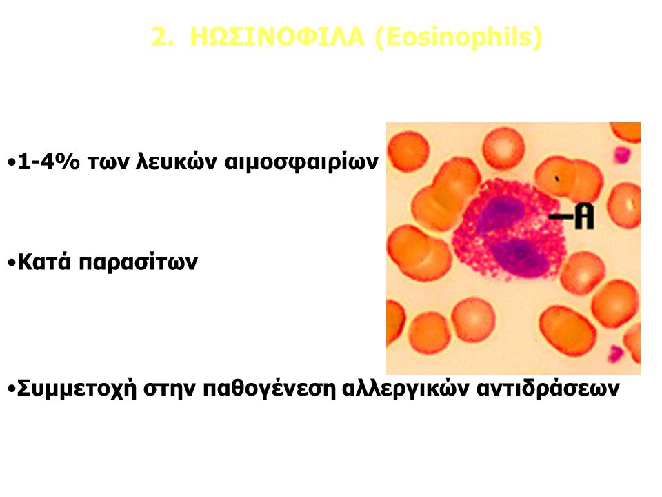 2. ΗΩΣΙΝΟΦΙΛΑ (Eosinophils)
