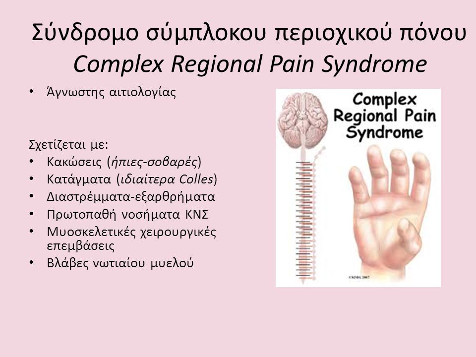 Σύνδρομο σύμπλοκου περιοχικού πόνου Complex Regional Pain Syndrome