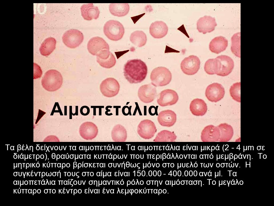 Αιμοπετάλια