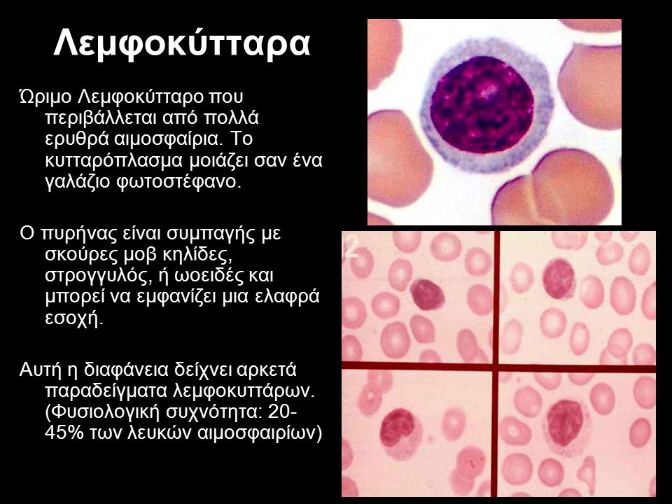 Λεμφοκύτταρα Ώριμο Λεμφοκύτταρο που περιβάλλεται από πολλά ερυθρά αιμοσφαίρια. Το κυτταρόπλασμα μοιάζει σαν ένα γαλάζιο φωτοστέφανο.