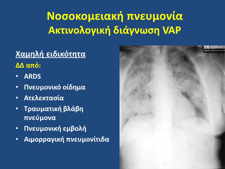 Νοσοκομειακή πνευμονία Ακτινολογική διάγνωση VAP